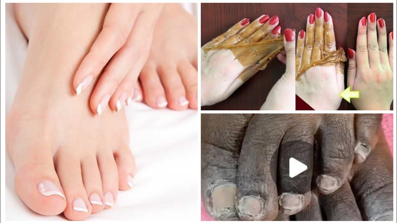 just rice and potatoes skin lightning 😱 baris iyo baradho un kucadey