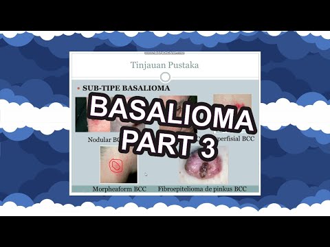 Kanker Ganas bisa seperti luka?? | Basal Cell Carsinoma (BCC) | Ulkus Rodent |  CC.ID | PART 3