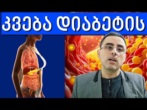 დიეტა დიაბეტის დროს რისი ჭამა შეიძლება და რისი არა