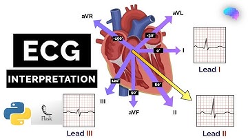 Detection of Cardiovascular Disease Using ECG Images in Machine Learning and Deep Learning | FLASK