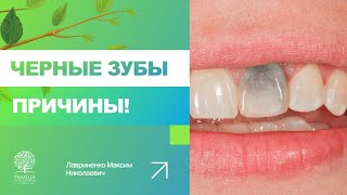 🤔 Почему появляются черные точки на зубах?