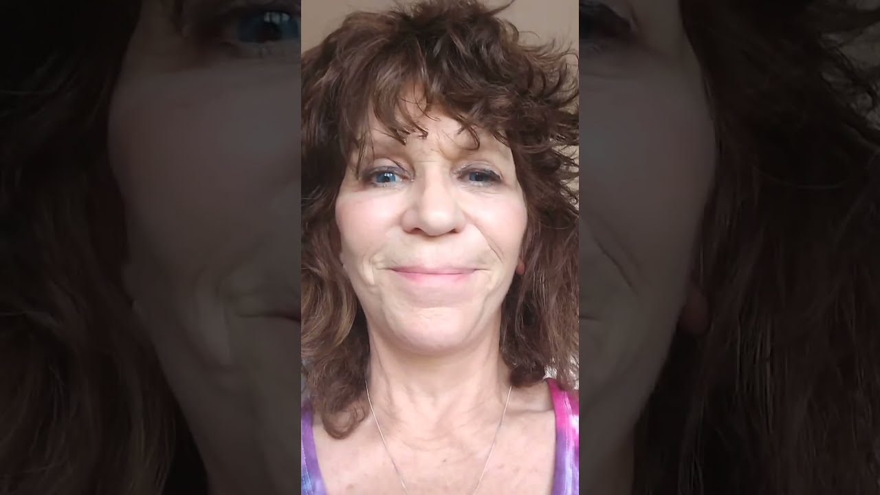 Lynn's Facelift Story - Short Scar Facelift Quick In Office Surgery Quick Recovery