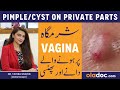 Pimple on private parts  sharamgah par danay ka ilaj  vaginal cyst  prevent inner thigh pimples