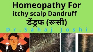 Dandruff? ItchyScalp? Homeopathic Medicine? screenshot 1