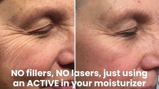 NO fillers, NO lasers, just using an “active” in your moisturizer 🥰 by Nerida Joy 2,159 views 1 year ago 1 minute, 30 seconds