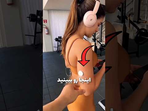 برچسب اندازه گیری گلوکوزش رو برداشت