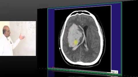 NEETPG Image Based MCQ