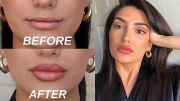 How do you fix thin lips?