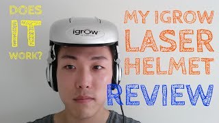 I Got An iGrow Laser Helmet! - YouTube