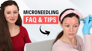 Microneedling FAQ & MustKnow Tips for Amazing Results