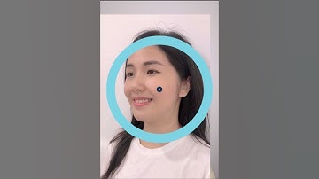 Niềng răng thay đổi bạn thế nào?