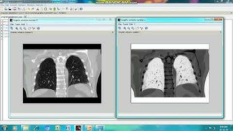 1  Image enhancement part1