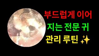 늦은 밤 조용히 이어지는 귀 관리 기록과 Soft Detail Reveal 순간 🌿 #ASMR screenshot 1