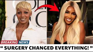 20 Black Celebrities Who Became More Beautiful After Cosmetic Surgery