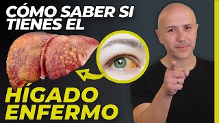 ¡SALVA TU HÍGADO! CONOCE LOS SIGNOS DE ALERTA Y MIS MEJORES RECOMENDACIONES | Dr. Carlos Jaramillo