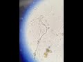 Germinated fungal spore and possible spirochete?