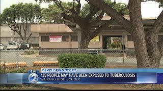 State notifies Waipahu students, parents, staff of possible tuberculosis exposure