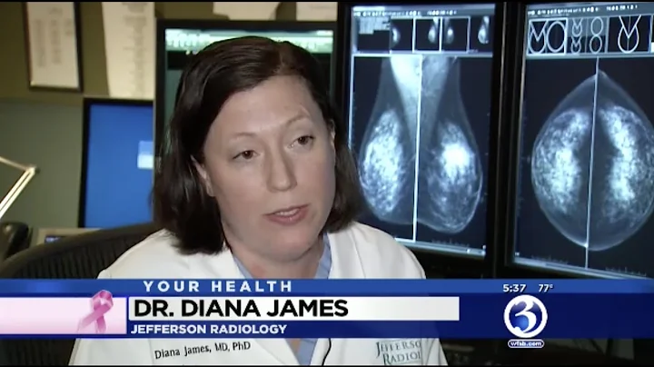 Dr. Diana James on WFSB
