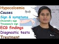 Hypocalcemia | Causes | Symptoms | ECG findings | Diagnostic Tests | Treatment