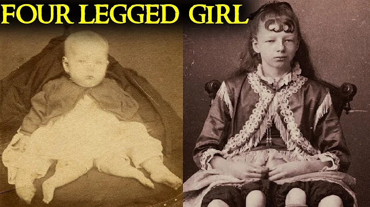 The Shocking True Story of the "Four-Legged Girl" ...