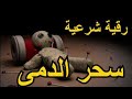 الرقية الشرعية من سحر الدمية المسامير في الجسم رقية قوية للأمراض Strong Roqyah For Magic الرقية الشرعية من سحر الدمية المسامير في الجسم رقية قوية للأمراض Strong Roqyah For Magic
