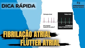 Fibrilação Atrial Versus Flutter Atrial