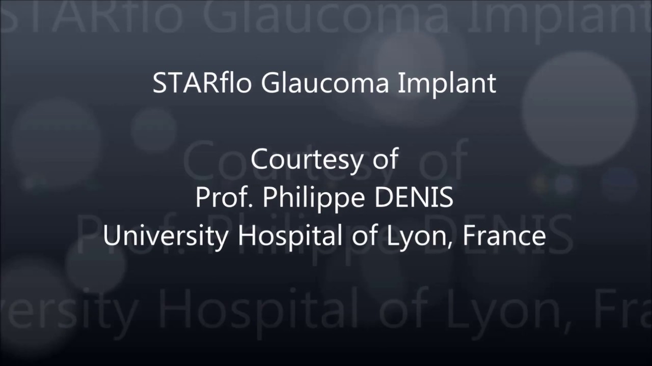 STARflo implantation surgery - Prof. Philippe Denis