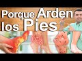 Porqué Me Arden Los Pies? - Causas Y Soluciones Para El Ardor Y Dolor En Los Pies