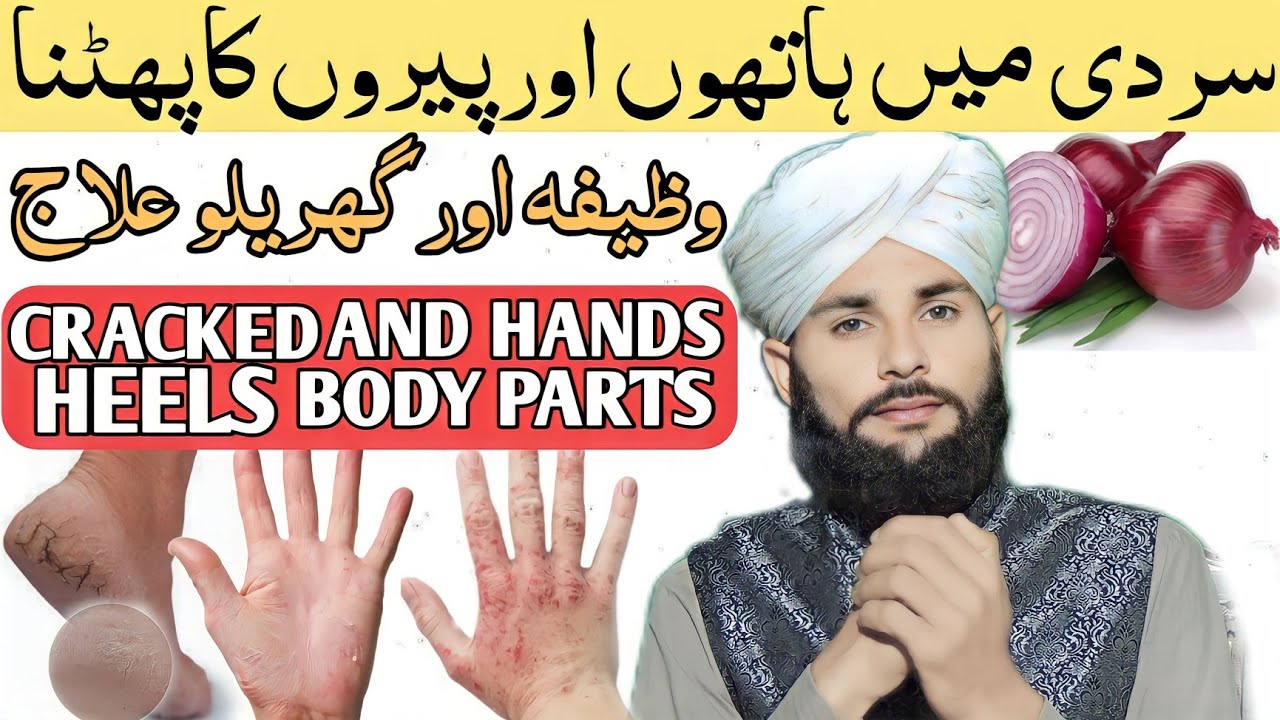 sardi-mai-hath-or-paon-phatne-ka-wazifa-or-ilaj-cracked-heels-dry