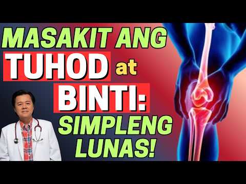 Masakit ang Tuhod at Binti - Payo ni Doc Willie Ong