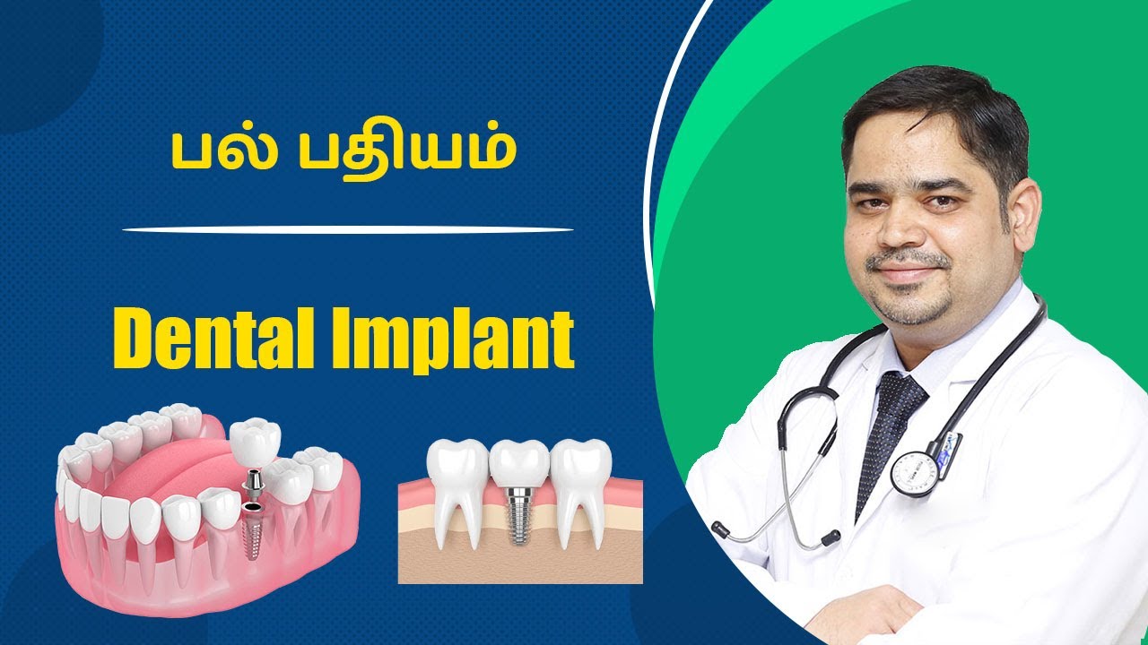 Dental Implant பல் பதியம் Dr Abisheik Johnson Babu Trinity Dental