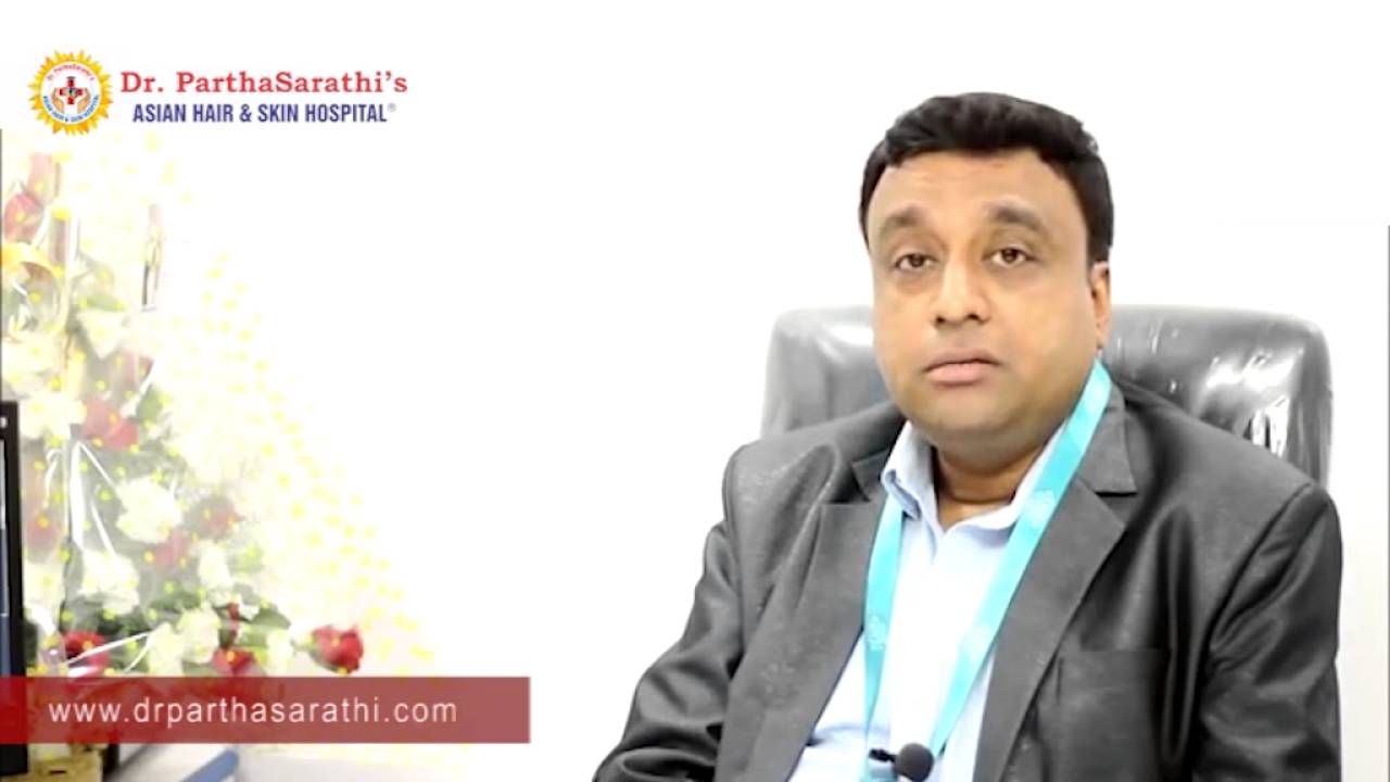 How to Treat Hair Fall Hair Fall Treatment in Bangalore Hair