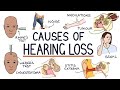 Understanding the causes of hearing loss