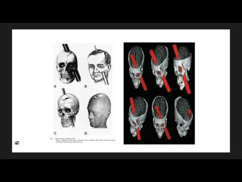 Vídeo: Diferencia Entre Agresión Hostil E Instrumental