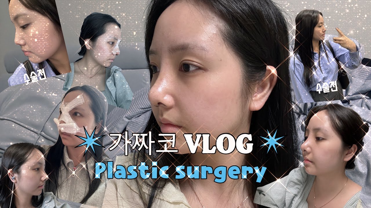 [Vlog]코수술브이로그｜직장인코수술｜가짜코브이로그👃🏻｜1일차~10일차 기록(부산 코수술, 코수술 전/후, 붓기관리, 붓기템)