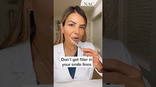 Don’t get filler in your smile lines #drbitafarrell #fillers #beauty