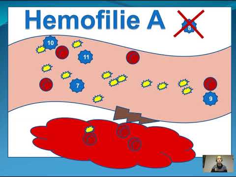 Video: Geprogrammeerde Sporttherapie (PST) Bij Mensen Met Hemofilie (PwH) 