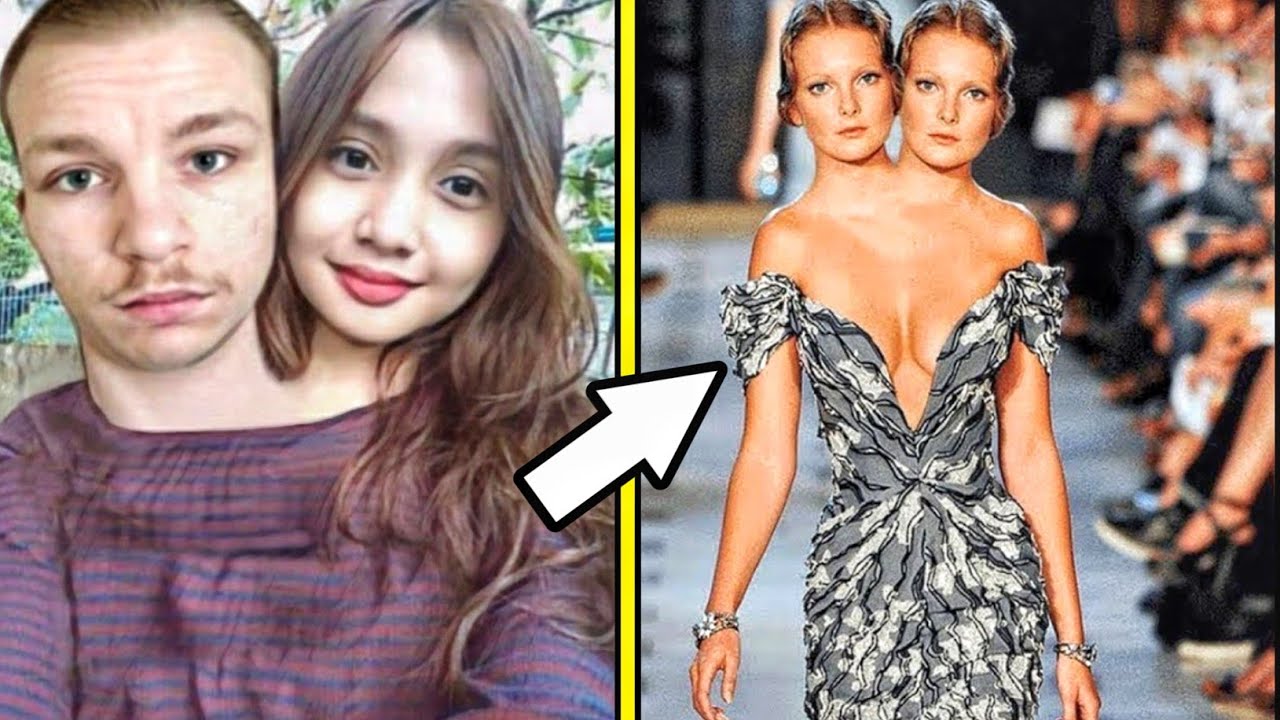 6 Fälle von Zwillingen, die Genetiker verblüfft haben