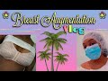 Breast Augmentation VLOG!!!!!!! CG Cosmetic— Miami, FL