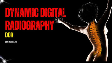 Unveiling Dynamic Digital Radiography DDR ‑ TAG