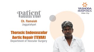Thoracic Endovascular Aortic Repair (TEVAR) | Yashoda Hospitals Hyderabad