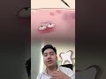 Vỡ Ven - Hiện Tượng Vỡ Ven Khi Ti&ecirc;m #nhakhoa #suckhoe