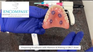 ENCOMPASS Step 2: Preparing the Prosthesis with Markers & Making a CBCT Scan for Zest ENCOMPASS! screenshot 4