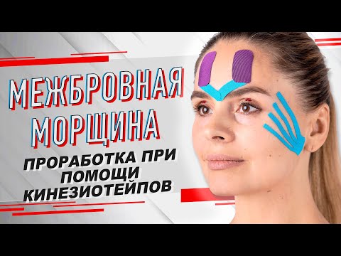 ▶️ МЕЖБРОВНАЯ МОРЩИНА /МЕТОДИКА ПРОРАБОТКИ ПРИ ПОМОЩИ КИНЕЗИОТЕЙПИРОВАНИЯ | Валентин Гайт | BBALANCE