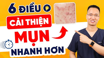 6 Điều giúp mụn cải thiện nhanh hơn ngay tại nhà - Trị mụn mọc ở cằm giúp da đẹp hơn | Dr Hiếu
