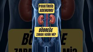 Paratiroid Adenomu Böbreğe Zarar Verir mi?