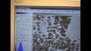 Transmission Electron Microscope, Part 2 of 2