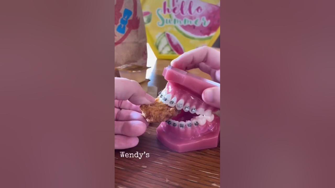 part-1-eating-chicken-nuggets-with-braces-bracesfood-youtube