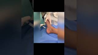 Tratamento De Fascite Plantar