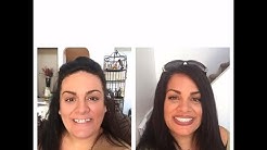 Smile Makeover in 8 days in Cancun 70% less than US 